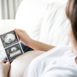 Second trimester of pregnancy