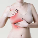 Hardening of Breast During Breastfeeding