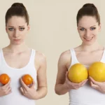 The Pros and Cons of Breast Expansion